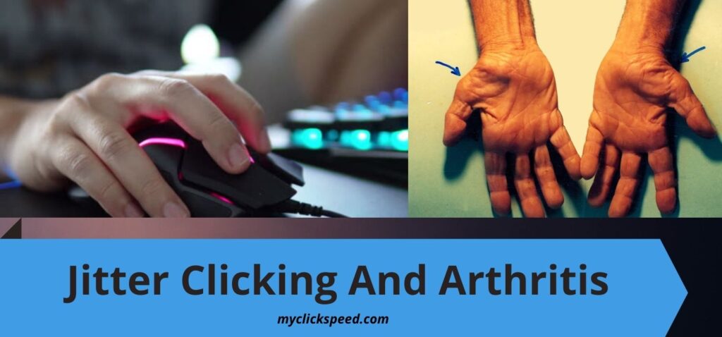 Can Jitter Clicking Cause Arthritis